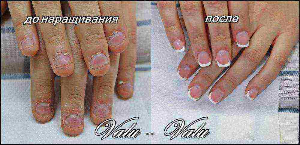 how to grow nails in 2 days at home