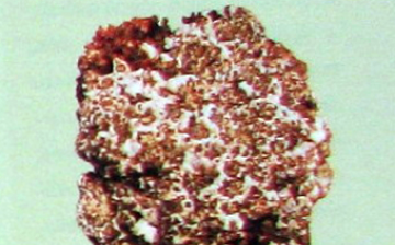 Bacterial rot of cauliflower heads